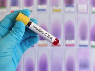 A tube of sample for Hepatitis C Test