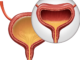 Overactive Bladder/Urinary Incontinence Medication Category