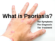 The hand with Psoriasis symptoms