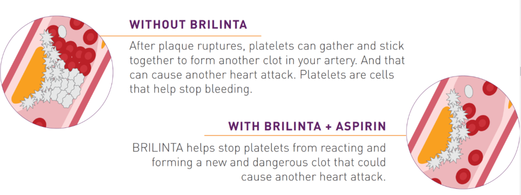 is brilinta a blood thinning drug