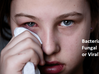The girl have eyes problem- red eye and "Bacterial Fungal or Viral"