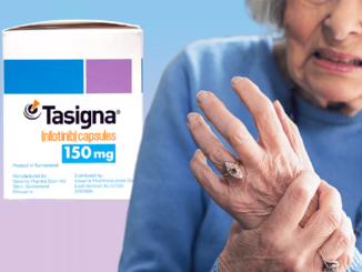 The box of Tasigna 150 mg and the woman has hand pain.